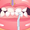 Làm đẹp răng ngày Tết (Bad Teeth Makeover)
